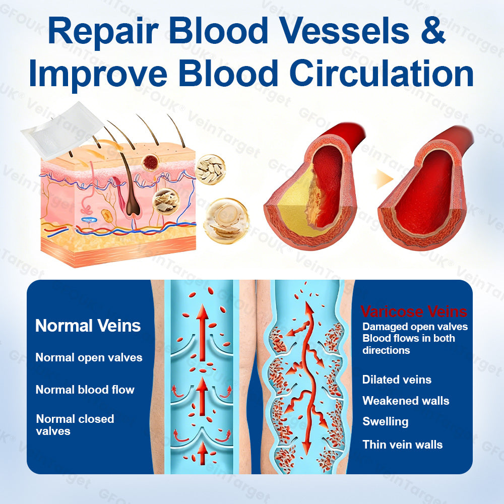 🇬🇧❤️🦵✅GFOUK® EKlinisk Microneedle Patch (with Diosmin & Hesperidin) is an advanced plant-based formulation specially developed to target spider veins and varicose veins, while also helping to relieve the feeling of heavy and tired legs.-K2